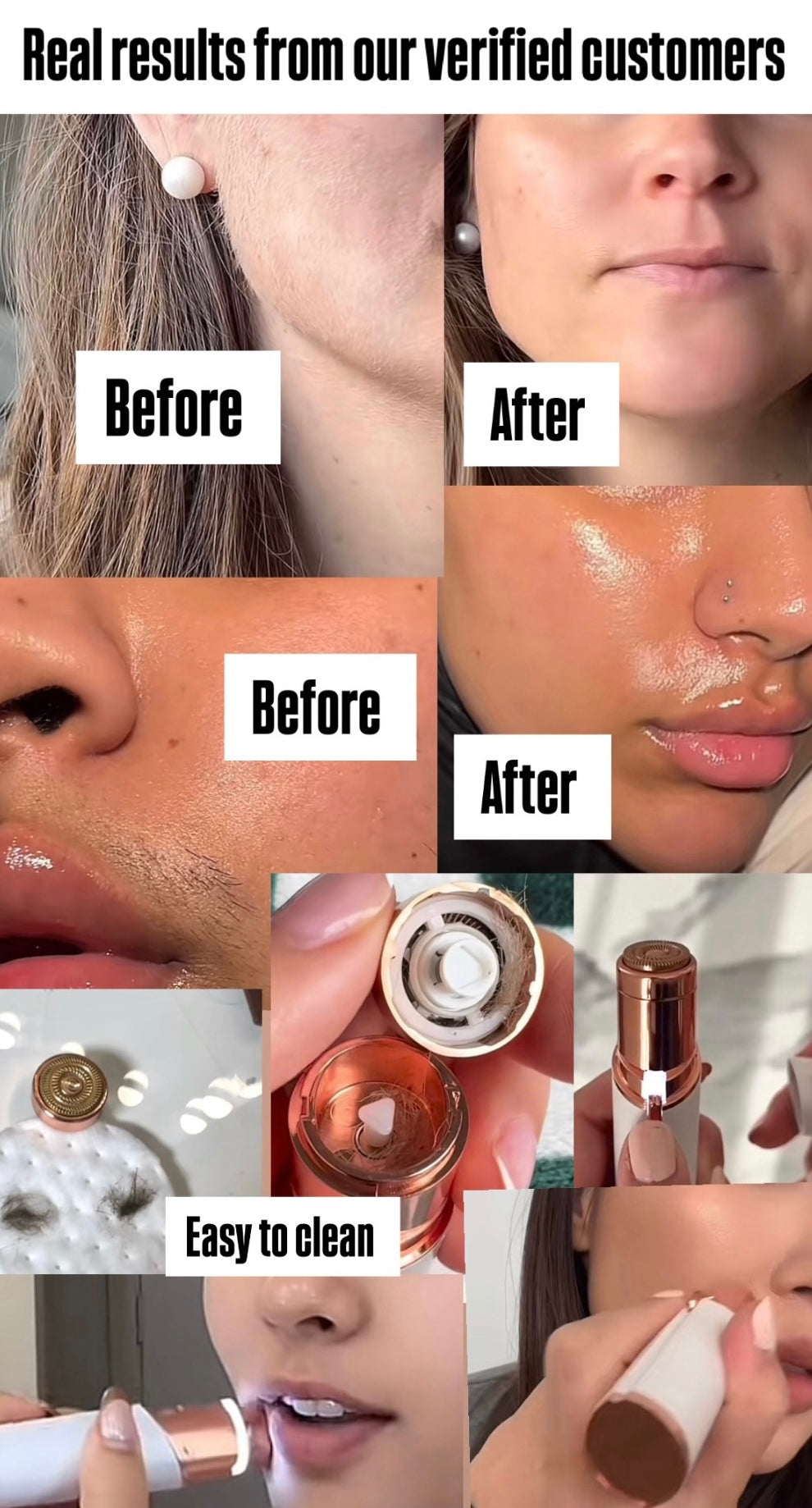 ELITEBLOOM™ Smart Portable Hair Removal Device – For Smooth, Radiant Skin